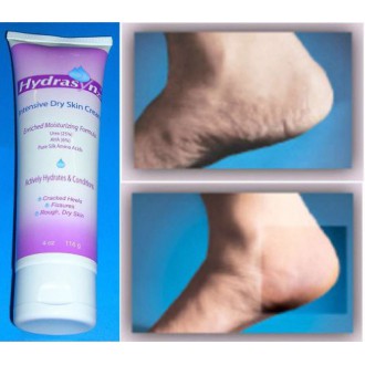 Hydrasyn25 25% Urea Piel Seca talones agrietados Foot Cream 4 oz / 116g Recomendado por el Doctor Hydrasyn 25